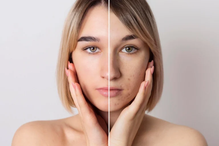 before-after-portrait-woman-retouched_23-2149121636